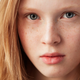 ¿Por qué no todos los pelirrojos tienen pecas? No lo sabemos. Imagen: Avemario / Shutterstock